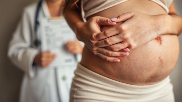 Comprendre les risques du valaciclovir durant la grossesse